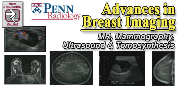 Penn Radiology's Advances in Breast Imaging
