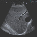 General Ultrasound CME