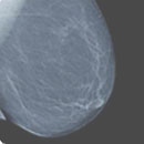 Breast Imaging CME