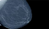 Breast Imaging