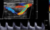 General Ultrasound Combos