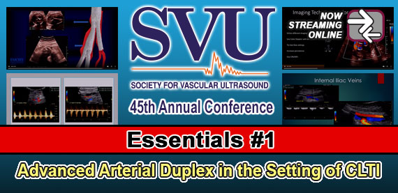 SVU Essentials #1: Advanced Arterial Duplex in the Setting of CLTI