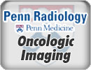 Penn Radiology's Oncologic Imaging: Optimizing Patient Care